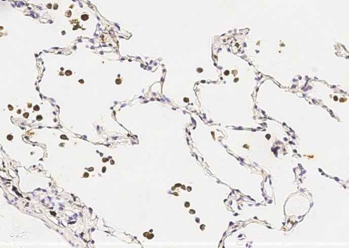 Anti-Human IL1B Antibody [A859] - ABMIUM