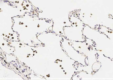 Anti-Human IL1B Antibody [A859] - ABMIUM