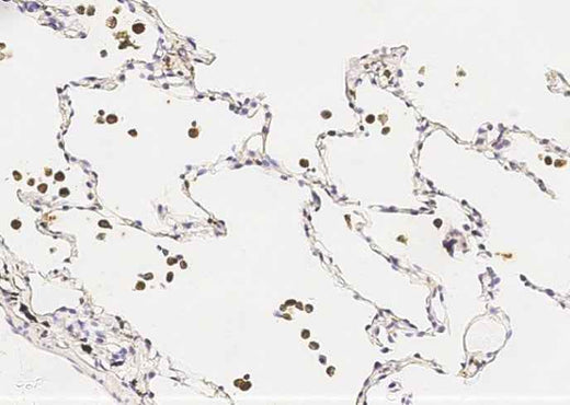 Anti-Human IL1B Antibody [A859] - ABMIUM