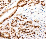 Anti-Human/Mouse CASP9 (active) Antibody - ABMIUM