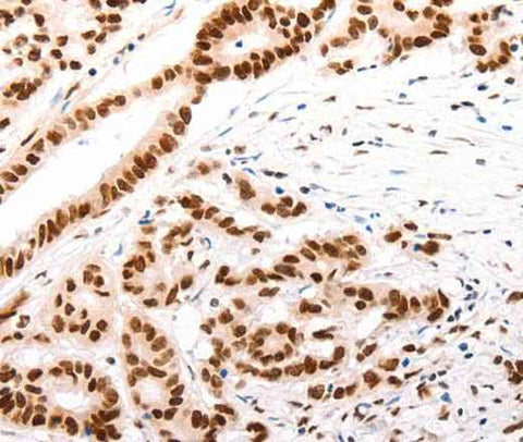 Anti-Human/Mouse CASP9 (active) Antibody