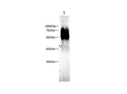 Anti-Human/Mouse/Rat PSAP Antibody - ABMIUM