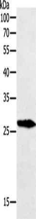 Anti-Human/Mouse/Rat GREM1 Antibody - ABMIUM