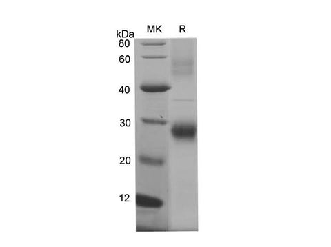 SDS-PAGE analysis of Mouse AFP proteins, 2 μg/lane of Recombinant Mouse AFP proteins was resolved with SDS-PAGE under reducing conditions, showing bands at 28.2 kDa.
