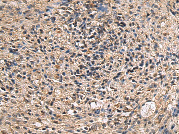 Immunohistochemistry of paraffin-embedded Human brain tissue using ITIH2 Polyclonal Antibody at dilution of 1:70(×200)