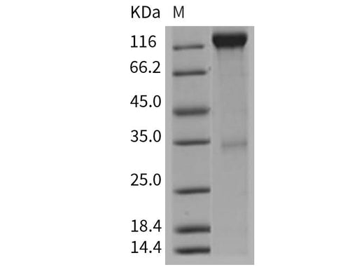 Recombinant Mouse VEGFR2/Flk-1/KDR Protein (Fc Tag) - ABMIUM