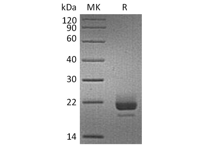 Recombinant Human CD40L/TNFSF5 Protein (His Tag) - ABMIUM