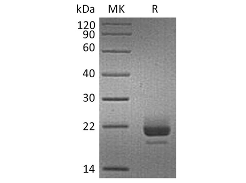 Recombinant Human CD40L/TNFSF5 Protein (His Tag) - ABMIUM
