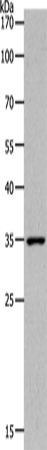 Anti-Human/Mouse MC2R Antibody - ABMIUM