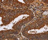 Anti-Human TICAM2 Antibody - ABMIUM