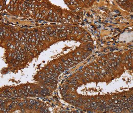 Anti-Human TICAM2 Antibody
