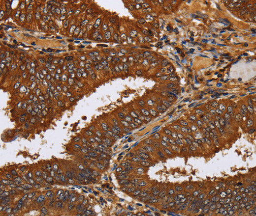 Anti-Human TICAM2 Antibody - ABMIUM