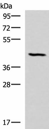 Western blot analysis of Mouse lung tissue lysate using SMPD2 Polyclonal Antibody at dilution of 1:1000