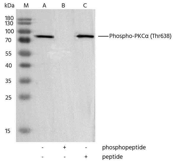 Anti-Human PRKCA Antibody [4B15] - ABMIUM