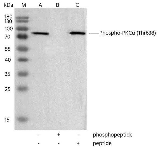 Anti-Human PRKCA Antibody [4B15] - ABMIUM