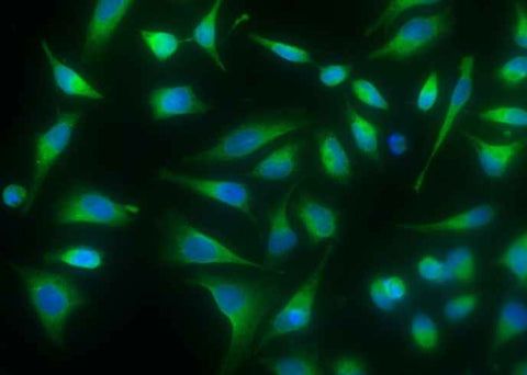 Anti-Human P4HB Antibody [B271] - ABMIUM