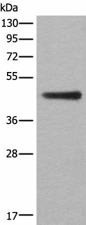 Western blot analysis of A431 cell lysate using ASS1 Polyclonal Antibody at dilution of 1:300
