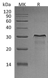 Recombinant Rat HER2/ErbB2 Protein (aa 67-323, His Tag) - ABMIUM