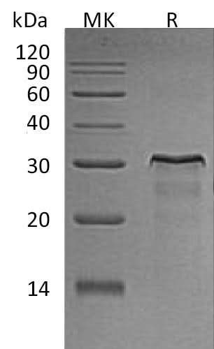 Recombinant Rat HER2/ErbB2 Protein (aa 67-323, His Tag) - ABMIUM