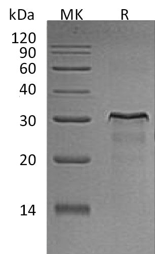 Recombinant Rat HER2/ErbB2 Protein (aa 67-323, His Tag) - ABMIUM