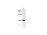 Anti-Human/Rat TTR Antibody - ABMIUM