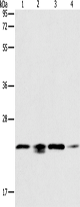 Anti-Human/Mouse/Rat PRDX2 Antibody - ABMIUM