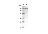 SDS-PAGE analysis of Mouse Prostatic Acid Phosphatase/PPAP proteins, 2 μg/lane of Recombinant Mouse Prostatic Acid Phosphatase/PPAP proteins was resolved with an SDS-PAGE under reducing conditions, showing bands at 66.8 kDa.