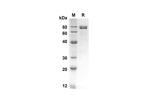 SDS-PAGE analysis of Mouse Prostatic Acid Phosphatase/PPAP proteins, 2 μg/lane of Recombinant Mouse Prostatic Acid Phosphatase/PPAP proteins was resolved with an SDS-PAGE under reducing conditions, showing bands at 66.8 kDa.