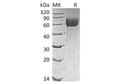 Recombinant Mouse IL13RA1 Protein (AVI & His Tag) - ABMIUM