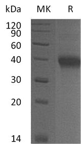 Recombinant Mouse OX40/TNFRSF4 Protein (His Tag) - ABMIUM