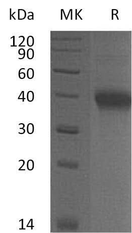 Recombinant Mouse OX40/TNFRSF4 Protein (His Tag) - ABMIUM