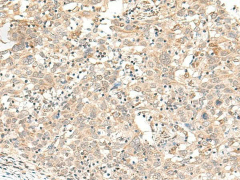 Anti-Human FUT3 Antibody - ABMIUM