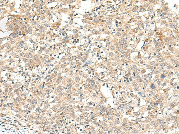 Anti-Human FUT3 Antibody - ABMIUM
