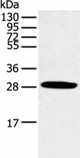 Western blot analysis of Human normal lung tissue using CLDN25 Polyclonal Antibody at dilution of 1:250