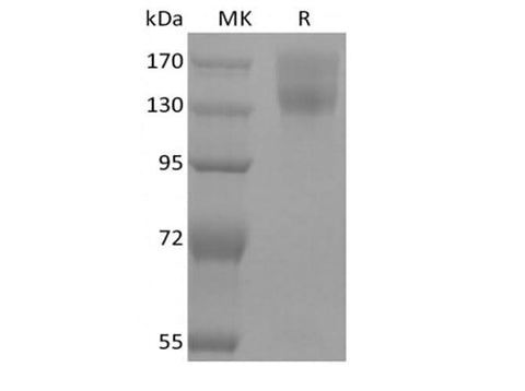 Recombinant Mouse Leptin Receptor/LEPR/CD295 (C-mFc) - ABMIUM
