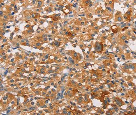 Anti-Human/Mouse/Rat PKC epsilon Antibody