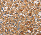 Anti-Human/Mouse/Rat PKC epsilon Antibody - ABMIUM
