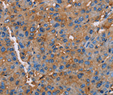 Anti-Human NLGN1 Antibody - ABMIUM