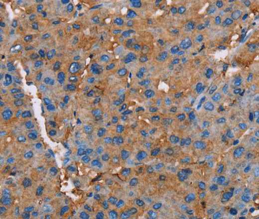 Anti-Human NLGN1 Antibody