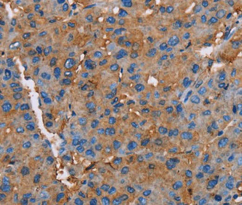 Anti-Human NLGN1 Antibody - ABMIUM
