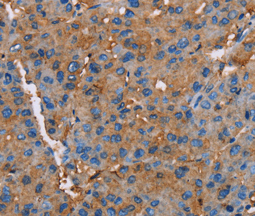 Anti-Human NLGN1 Antibody - ABMIUM