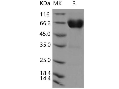 Recombinant Human CD300a/LMIR1 Protein (Fc Tag) - ABMIUM