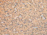 Anti-Human/Mouse AP2A1 Antibody - ABMIUM