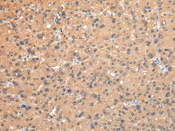 Anti-Human/Mouse AP2A1 Antibody