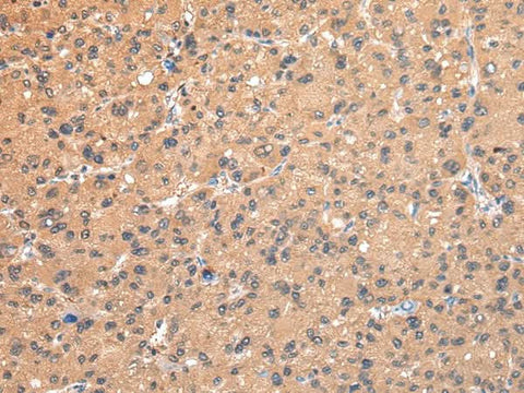 Anti-Human/Mouse AP2A1 Antibody - ABMIUM
