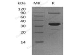 Recombinant Human GNMT Protein (His Tag) - ABMIUM