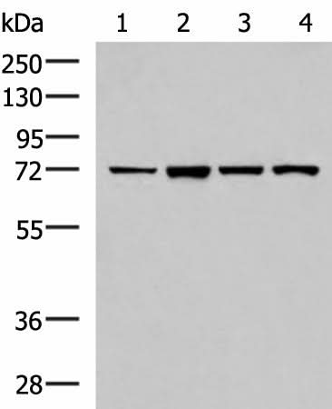 Western blot analysis of Jurkat cell Mouse liver tissue HepG2 cell Mouse kidney tissue lysates using ZAP70 Polyclonal Antibody at dilution of 1:800