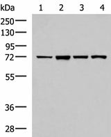Western blot analysis of Jurkat cell Mouse liver tissue HepG2 cell Mouse kidney tissue lysates using ZAP70 Polyclonal Antibody at dilution of 1:800