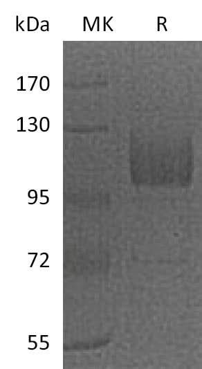 Recombinant Mouse CD36/SCARB3 Protein (Fc Tag) - ABMIUM