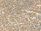 Immunohistochemistry of paraffin-embedded Human tonsil tissue using THG1L Polyclonal Antibody at dilution of 1:50(×200)
